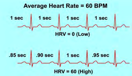 HRV